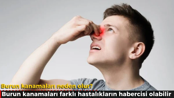 Burun kanamaları neden olur? 