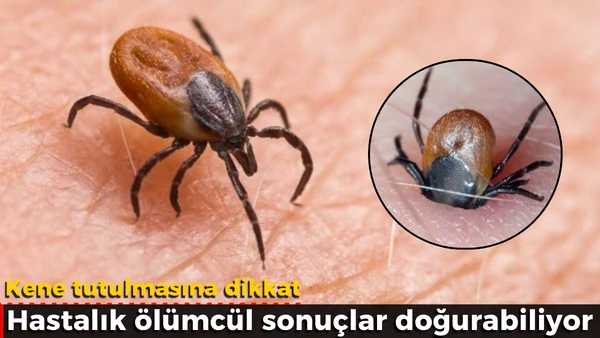 Kene tutulmasına dikkat 